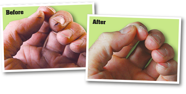 Before and After Hand Images